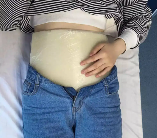 蜡疗的功效与作用