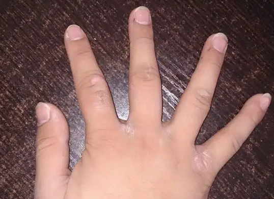手上皮肤很粗糙怎么办