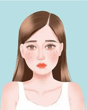 产后黄褐斑怎么去掉
