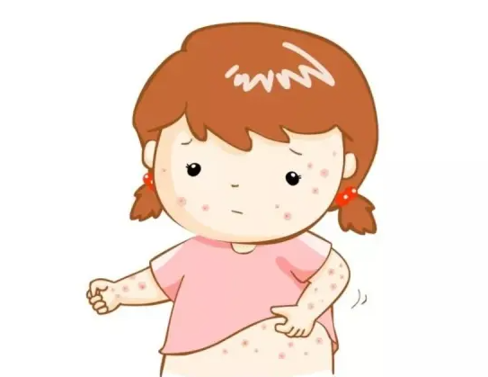 婴儿皮肤肤色不均的原因