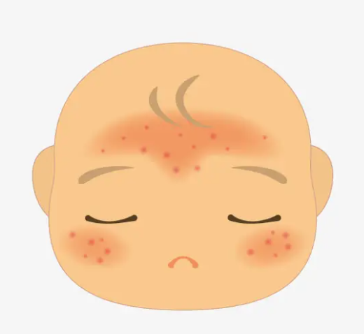 宝宝脸上皮肤有白块
