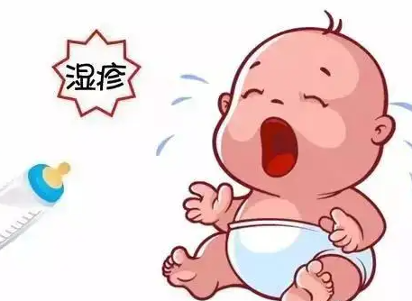 宝宝脸上长奶癣擦什么