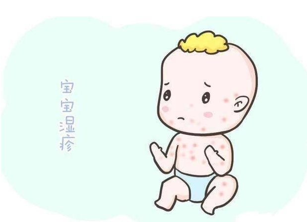 宝宝长奶癣怎么办