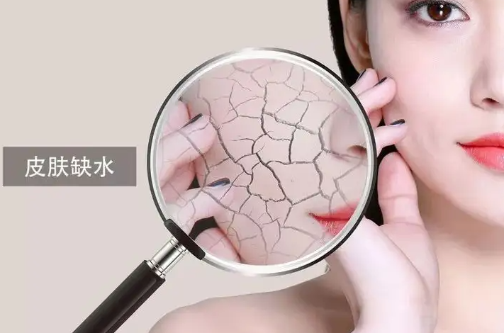 皮肤干燥为什么会痒