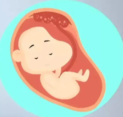 什么是胎盘钙化