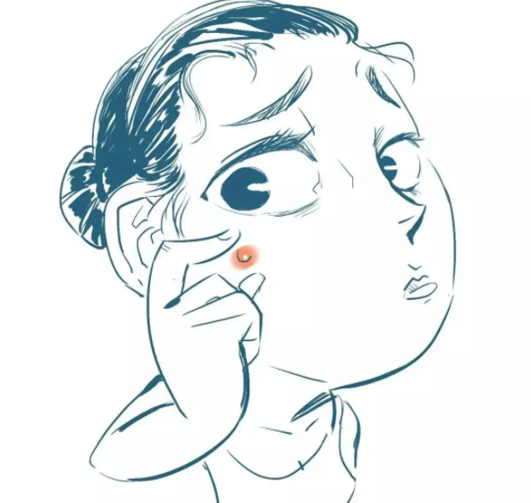 痘痘告诉你哪里生病了 教你怎么快速消除痘痘