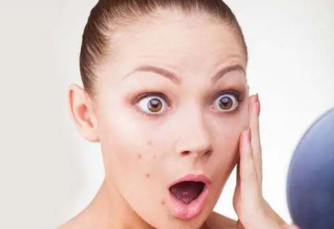 如何快速消除黑色痘印 去黑色痘印的方法