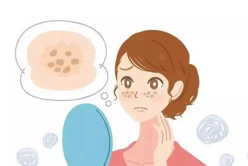 怎样去斑