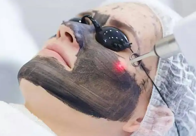 黑脸娃娃可以祛痘吗 祛痘美肤的神奇护肤项目