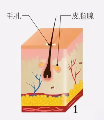 微针去痘坑效果好不好 严重痘坑不建议做微针治疗