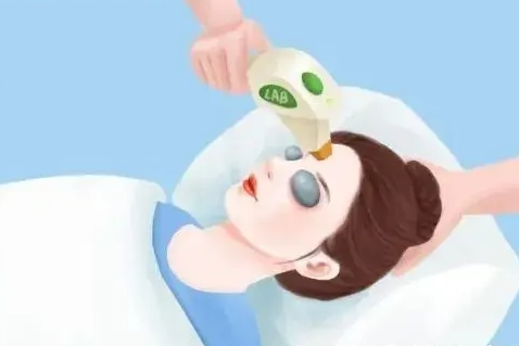 光子嫩肤能去痘印吗  光子嫩肤终于来拯救痘印了