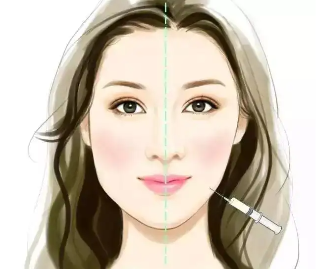 瘦脸针那个牌子的最好 正规瘦脸针优缺点大火拼