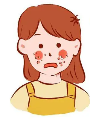 痤疮疤痕的祛除小妙招