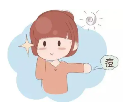 痤疮产生的根本原因有哪些
