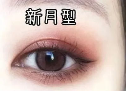 4种双眼皮类型图片