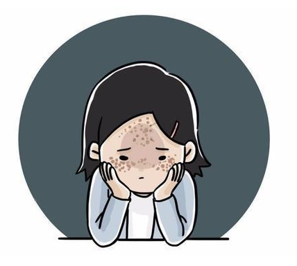 产后如何祛斑最有效的办法