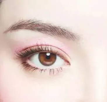 常见的割双眼皮的方法