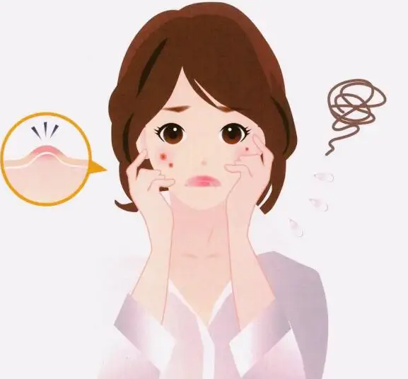 怎么去除粉刺
