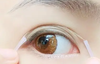 双眼皮贴怎么使用 间歇性使用双眼皮贴