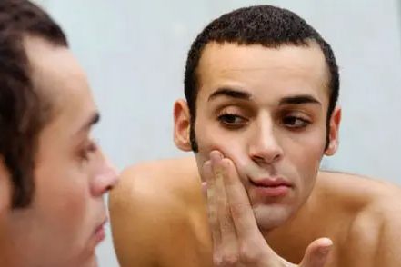 如何去痘痘最快方法 男生怎么去痘