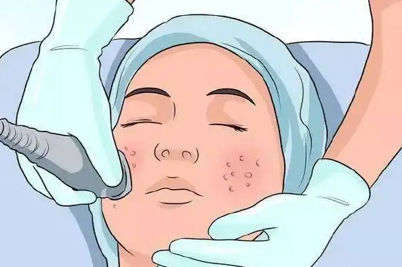 怎么清洁肌肤 卸妆只是使用卸妆乳液就行了吗