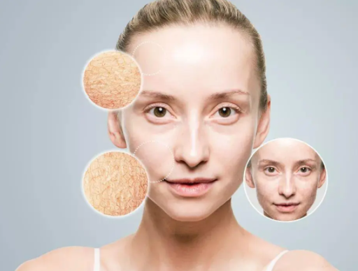 秋季皮肤干燥应该怎么应对