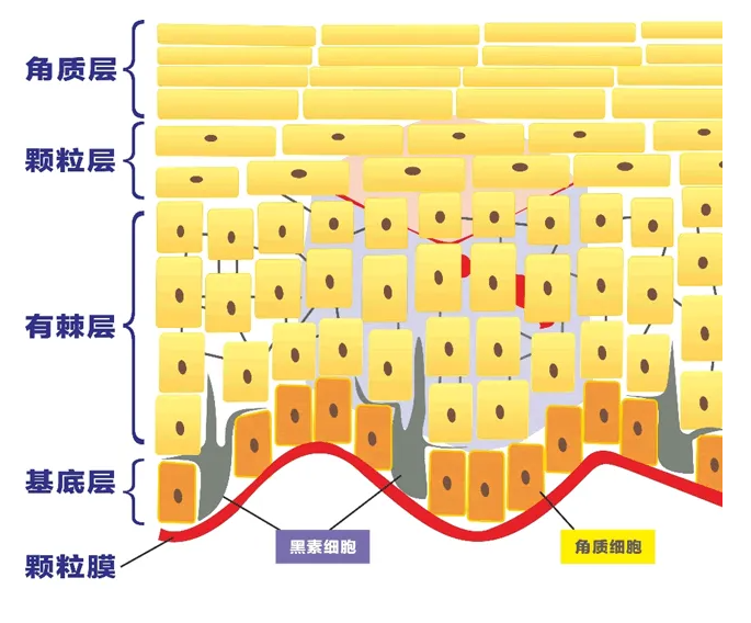 如何修复受损面部角质层