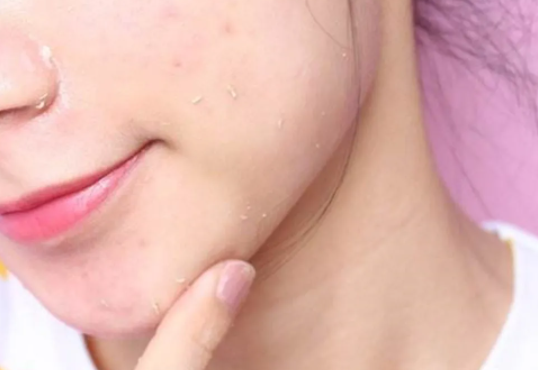 女性怎样快速美白