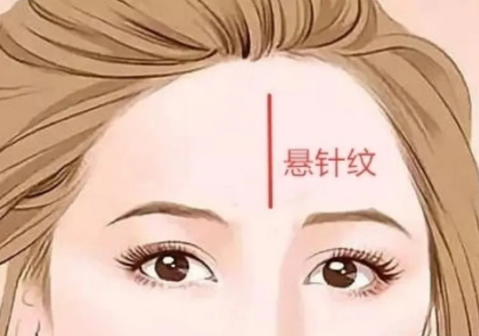 为什么会长悬针纹 悬针纹怎么去除