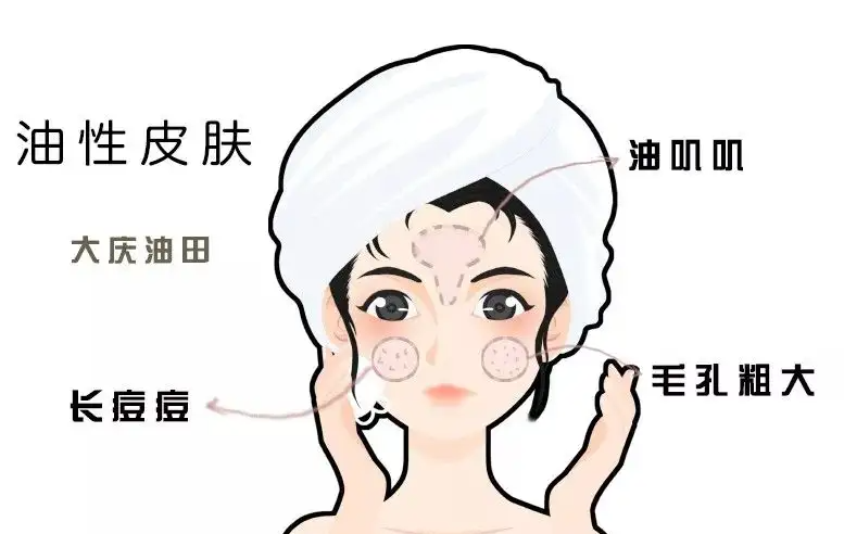 怎么判断自己的肤质 怎么根据肤质挑选护肤品