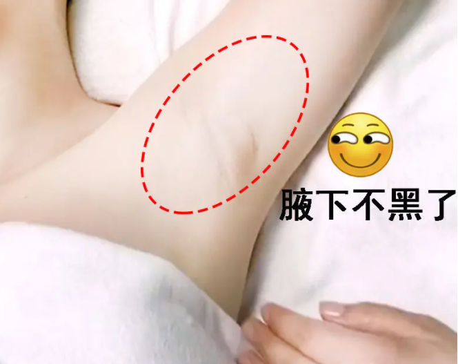 腋下怎么进行美白 腋下为什么会黑黑