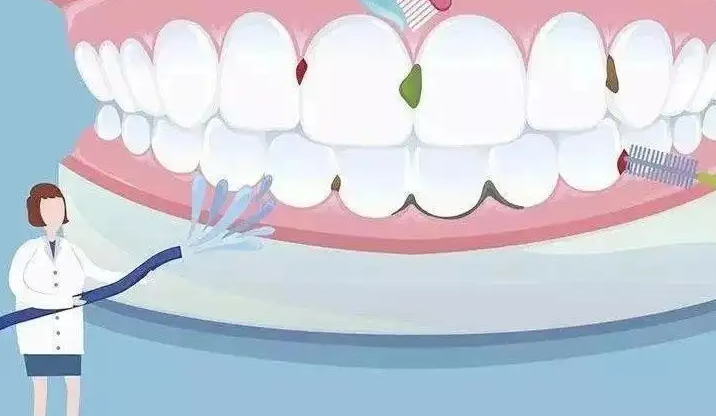 四环素牙如何美白 四环素牙美白方法