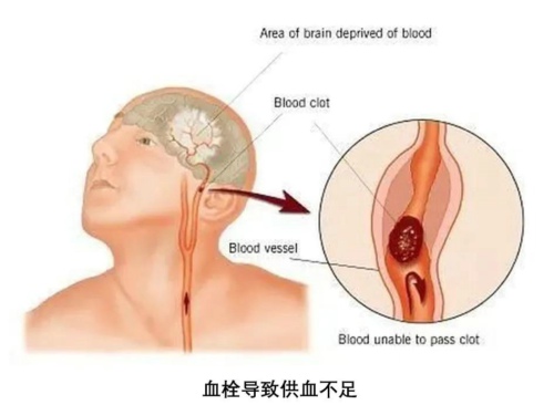千万不要触碰这个雷区