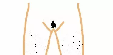 泪滴式