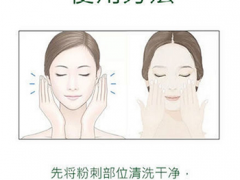 粉刺露的使用方法 粉刺露的作用和效果