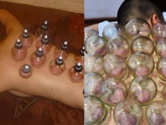 腹部的拔罐减肥方法有哪些 拔罐减肥的原理是什么