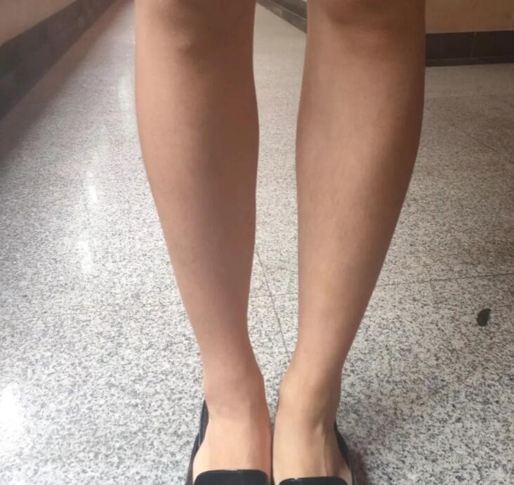 瘦腿针打几针可以保持永久？