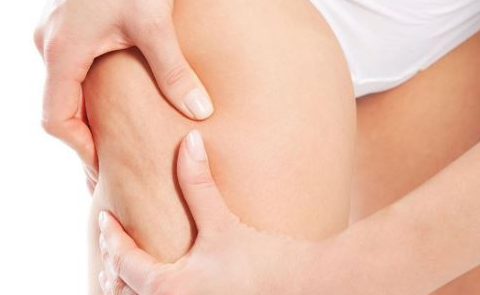 如何瘦大腿​​​​​​​ 教你轻松告别大象腿的减肥方法