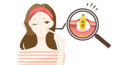 维a酸乳膏的正确用法去黑头粉刺、维a酸乳膏刷酸用法，你了解几分？