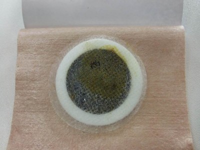 中药穴位贴沙蒿子透皮贴定制加工 儿童成长贴三伏贴OEM贴牌