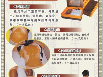 乐福缘泥灸
