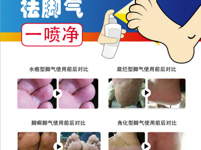 脚气水生产厂家  OEM贴牌定制脚气水 泡浴包