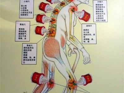 春草截跟拔罐器招商  加盟春草拔罐液价格